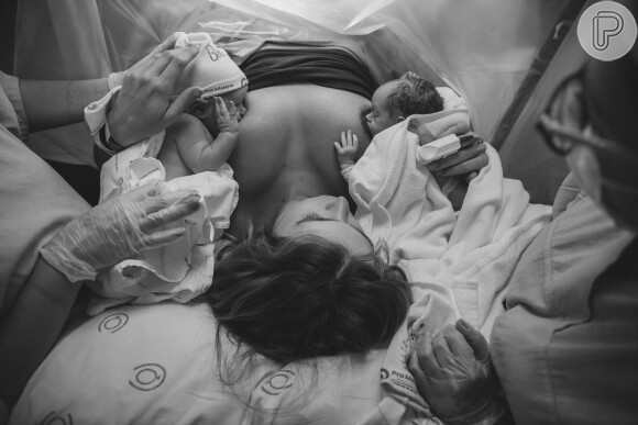 Filhos gêmeos de Isabella Scherer aparecem sendo amamentados na mesa de parto em foto publicada pela atriz