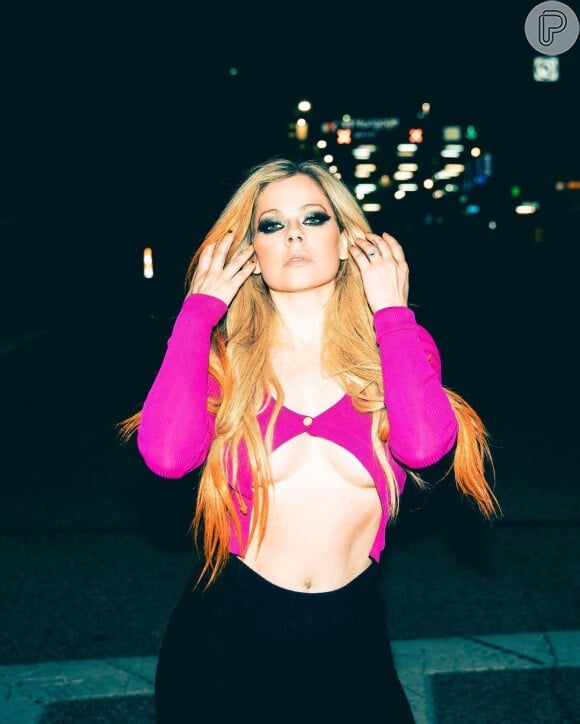 Dermatologista acredita que Avril Lavigne é adepta dos bioestimuladores de colágeno para manter aparência jovial do rosto