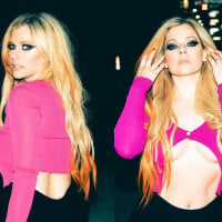 Aos 37, Avril Lavigne tem fonte da juventude? Dermato desvenda possíveis tratamentos e cuidados com rosto da cantora