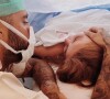 Filha de Pedro Scooby e Cintia Dicker passou por duas cirurgias logo após o parto