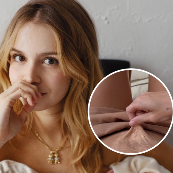Isabella Scherer desabafou ao mostrar sua barriga pós-parto