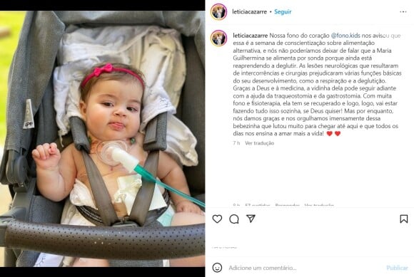 Filha de Juliano Cazarré teve sequelas após operações