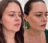 Harmonização facial de Mari Bridi foi feita com preenchedores e toxina botulínica
