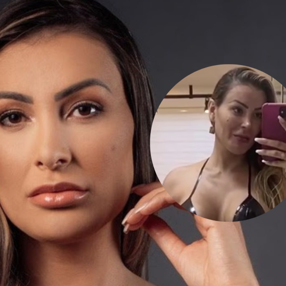 Andressa Urach mostrou aos fãs o resultado de um bronzeamento artificial