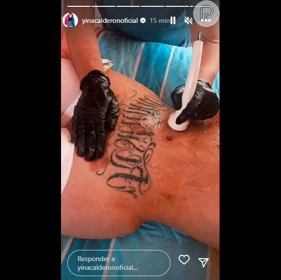 Yina, de qualquer forma, não desistiu dos procedimentos estéticos.