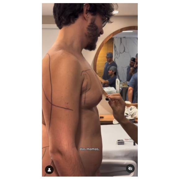 Eliezer além de fazer a cirurgia de ginecomastia também aproveitou para fazer uma lipoaspiração