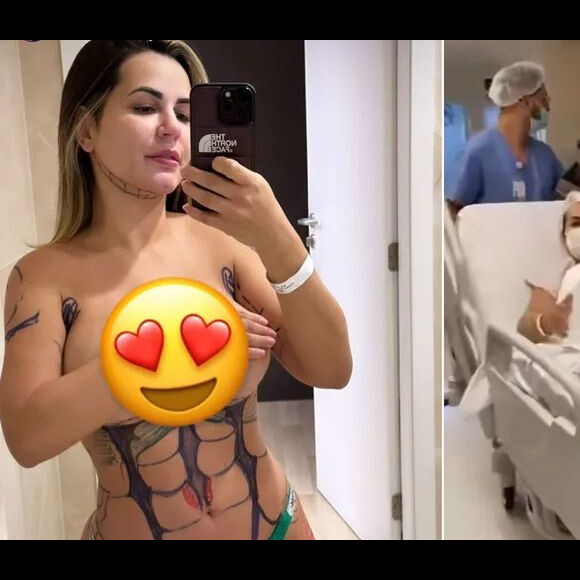 Deolane Bezerra foi submetida a uma lipo LAD com método exclusivo da Clínica JK Estética Avançada