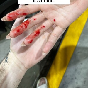 Gabi Lopes mostrou a mão com sangue após sofrer assalto em São Paulo