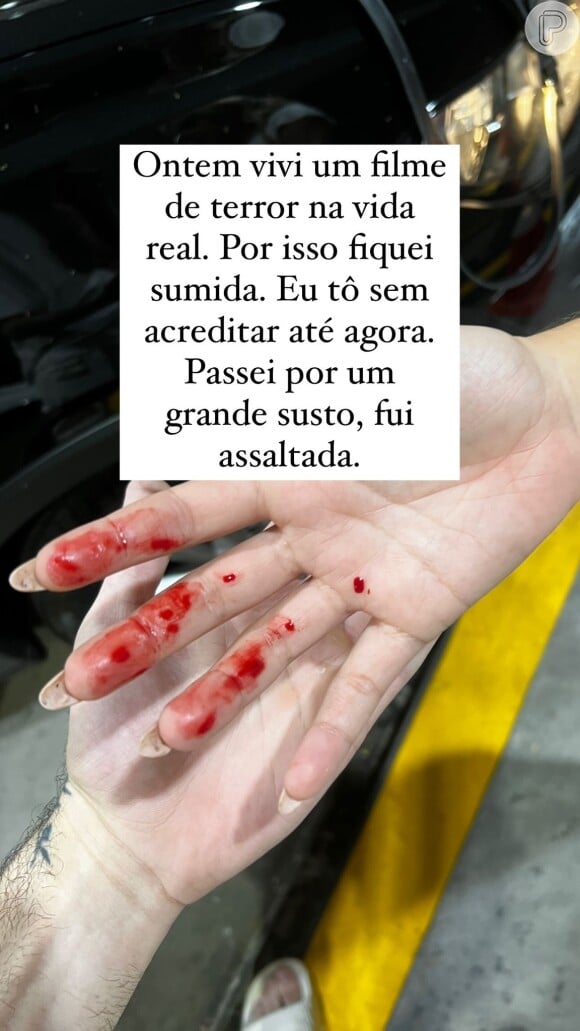 Gabi Lopes mostrou a mão com sangue após sofrer assalto em São Paulo