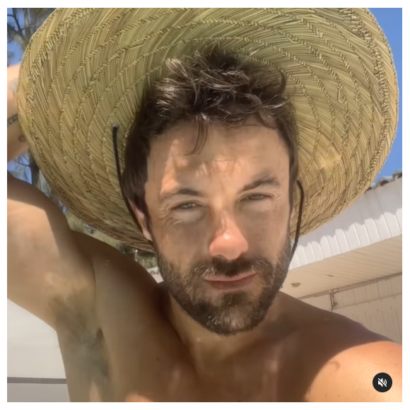 Kayky Brito sofreu um grave acidente de carro na Barra da Tijuca que quase tirou sua vida