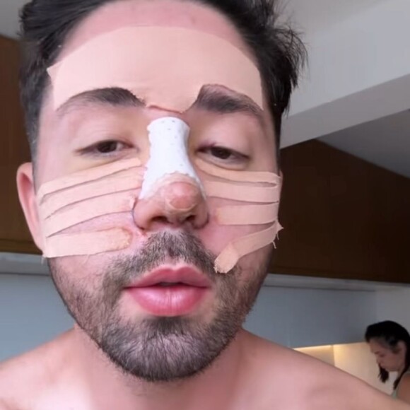 Rico Melquiades se envolveu em acidente de carro recentemente