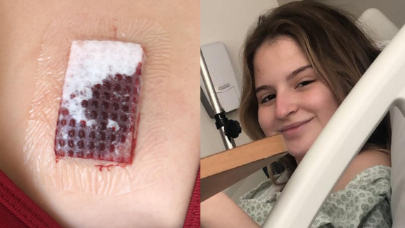 Sophia Valverde detalha experiência após cirurgia de retirada de nódulo no seio com 16 anos: 'Era igual a uma bola de tênis'