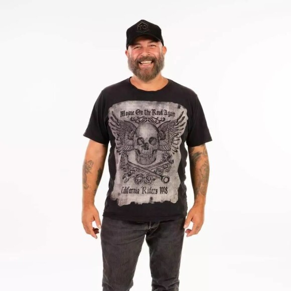 Mingau, do Ultraje a Rigor, vai passar por uma terceira cirurgia na cabeça para colocar uma prótese na cabeça; artista está sem a calota craniana