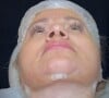 Irmã de Eliana passou por um procedimento de rejuvenescimento facial que mudou muito seus traços