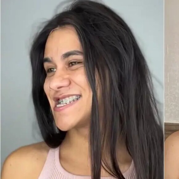 Gutierrez Castro, intérprete da personagem Leuriscléia, disse que a ortognática foi um dos maiores sonhos da sua vida