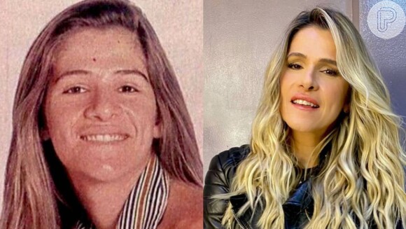 Ingrid Guimarães fez a cirurgia ortognática quando ainda tinha 20 anos