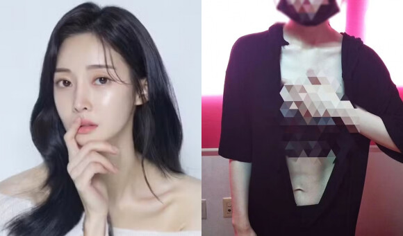 Estrela do K-pop tenta suicídio após agressão sexual do ex-marido; fotos divulgadas da violência doméstica são perturbadoras