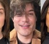 Além de Eliezer: veja 7 famosos que reverteram a harmonização facial