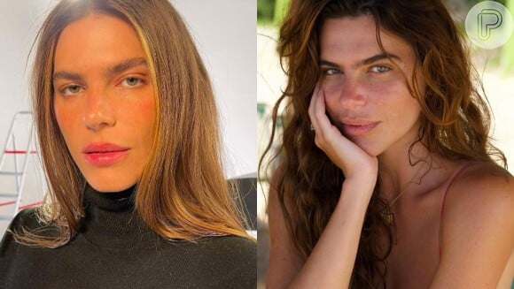 Mariana Goldfarb foi outra que prezou pelo seu rosto natural depois de não se enxergar mais com harmonização facial