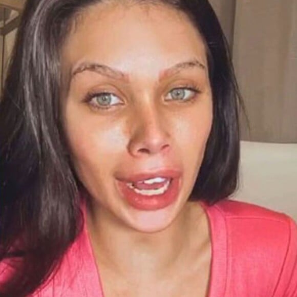 Flavia Pavanelli chocou muita gente ao surgir com procedimentos exagerados no rosto. Depois de muitas críticas, a influenciadora desfez sua harmonização facial