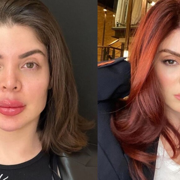 Gkay passou por um cancelamento severo nas redes sociais e ressurgiu mais natural, retirando a harmonização facial