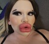 Andrea Ivanova tem o título de pessoa com os maiores lábios do mundo
