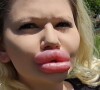 Andrea Ivanova é uma influenciadora búlgara que choca a internet com o tamanho dos seus lábios