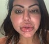 Liziane Gutierrez de 'A Grande Conquista 2' fez harmonização facial que deu errado em 2018