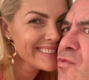 Ana Hickmann afirma ter tido o braço imprensado contra uma porta pelo ex-marido, Alexandre Correa, durante uma discussão