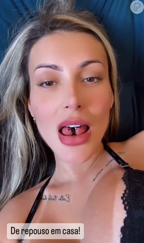 Andressa Urach passou por um procedimento para a bifurcação da língua