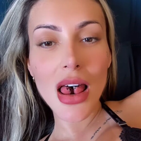 Andressa Urach passou por um procedimento para a bifurcação da língua