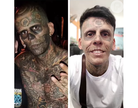 Homem mais tatuado do Brasil surpreende com atual aparência após duas sessões de remoções de tatuagem do rosto