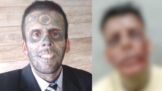 Quem é o homem mais tatuado do Brasil? Convertido, ele está removendo as tatuagens do rosto e sua atual aparência vai te surpreender
