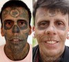 Homem mais tatuado do Brasil está removendo suas tatuagens em parceria com um estúdio, que irá fazer um documentário sobre sua vida