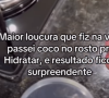 As fezes ainda não tiveram sua eficácia cientificamente comprovada como produtos de skincare.