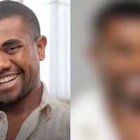 Davi Brito, campeão do 'BBB 24', coloca lentes nos dentes e novo sorriso divide a web: 'Tá igual um piano'. Veja antes e depois!