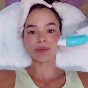 Em seu rosto, Bruna Marquezine utiliza o Ultrassom Microfocado, uma técnica que dá resultado de lifting facial sem aplicações