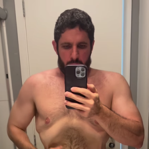 André Serra chegou aos 91 kg só com dieta e exercícios físicos, e agora fará uma abdominoplastia para remover a flacidez em sua pele