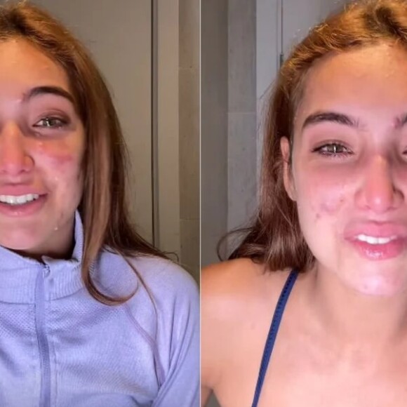 Na última terça-feira (29), Vanessa Lopes voltou a falar sobre o assunto e caiu no choro ao dizer estar 'se sentindo um monstro'