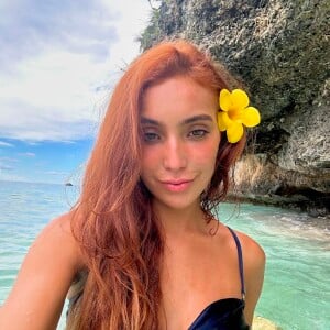 Há meses, Vanessa Lopes vem fazendo um tratamento contra acne e mostrado sua real pele nas redes sociais