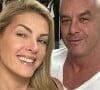 Ana Hickmann e Alexandre Correa eram casados em comunhão parcial de bens