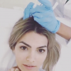 Kelly Key leva injeção na cabeça em tratamento de mesoterapia. Ela mostrou tudo em um pequeno vídeo no Instagram, na manhã desta sexta-feira (13)