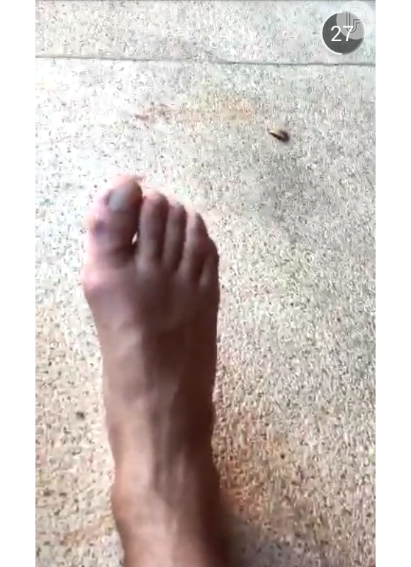 Caio Castro mostrou em sua conta de Snapchat como o dedo ficou após jogar futebol em campo de areia