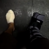 Caio Castro mostrou como os pés ficaram após deixar o hospital