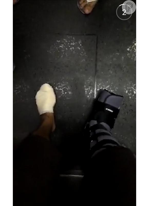 Caio Castro mostrou como os pés ficaram após deixar o hospital