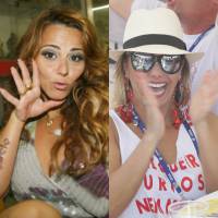 Viviane Araújo apaga tatuagem com o nome do ex, Belo. Compare antes e depois!