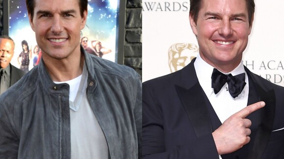 Tom Cruise aparece com o rosto inchado e chama atenção na web: 'Botox?'