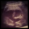 Ana Hickmann e Alexandre Correa publicaram uma foto do ultrassom do primeiro filho com ele fazendo sinal de positivo