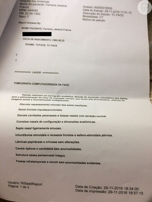 Documento obtido pelo Purepeople mostra a tomografia computadorizada de face feita por Jéssica França