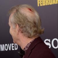 Bill Murray vai a lançamento de filme com a cabeça sangrando. Veja foto